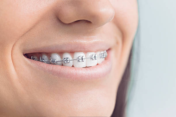 Full Mouth Reconstruction in Edmonton, KY